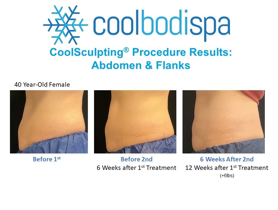 AC (Abs & Flanks) CS Comparison