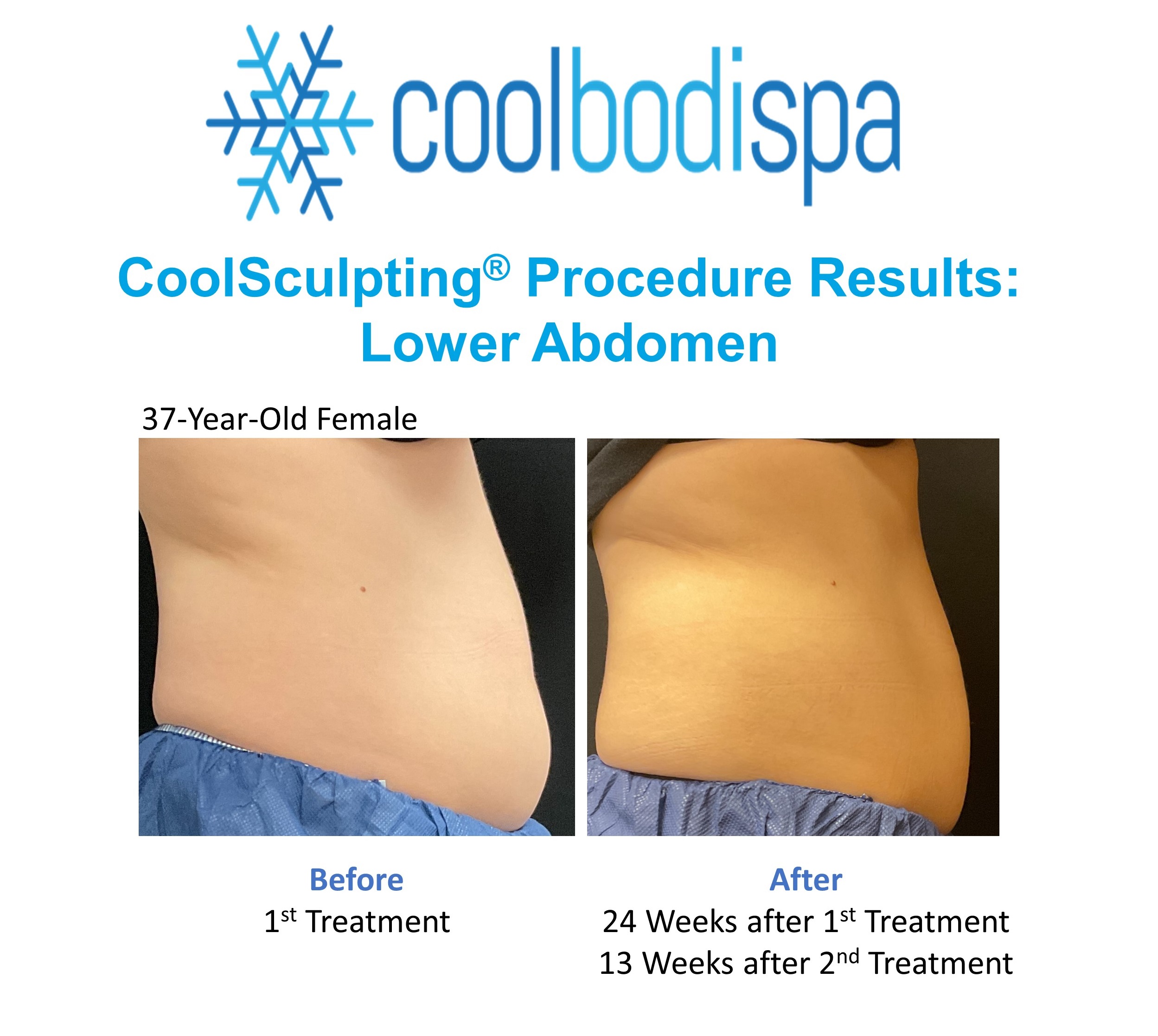 Ame A (L Abs) CS Comparison