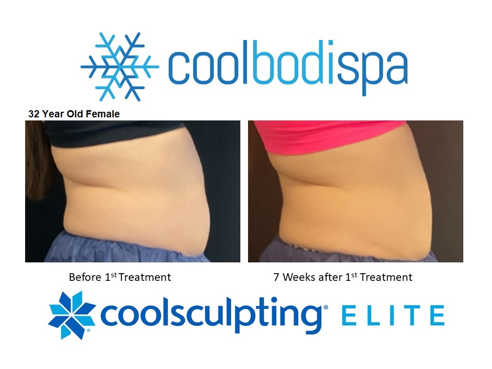 BR Elite Abs 7 Weeks