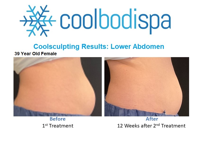 CL (L Abs) CS Comparison