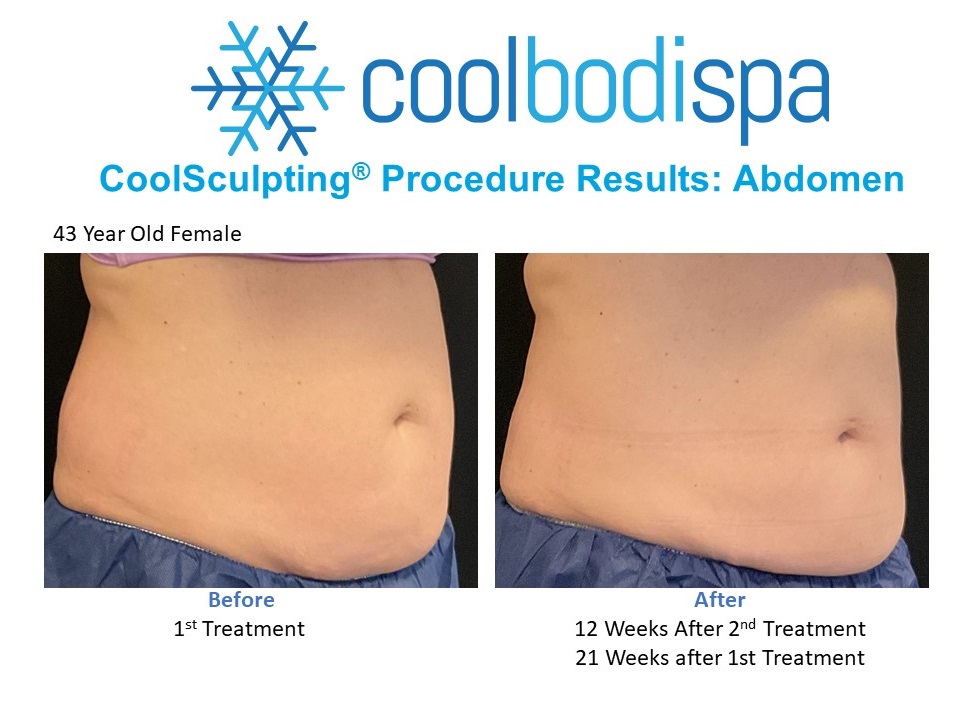 DW (Abs) CS Comparison-Rx
