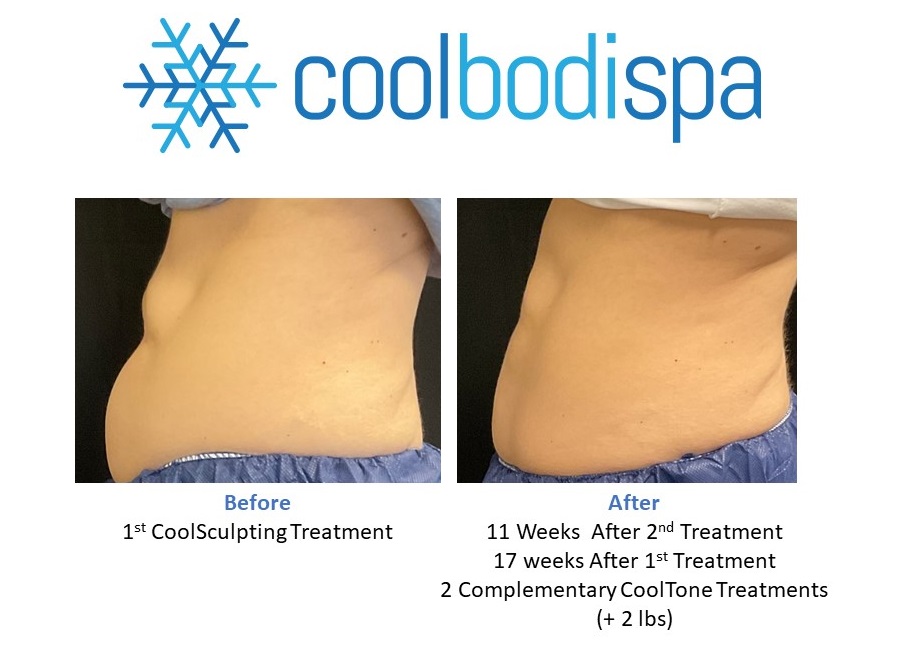 Deanna S (Abs) CS Comparison_2