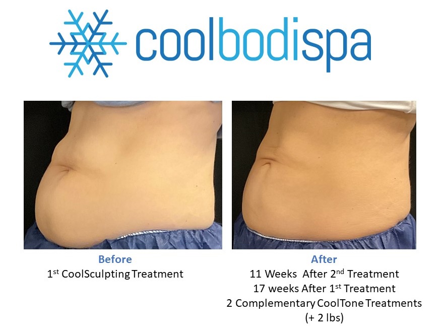 Deanna S(Abs) CS Comparison_1