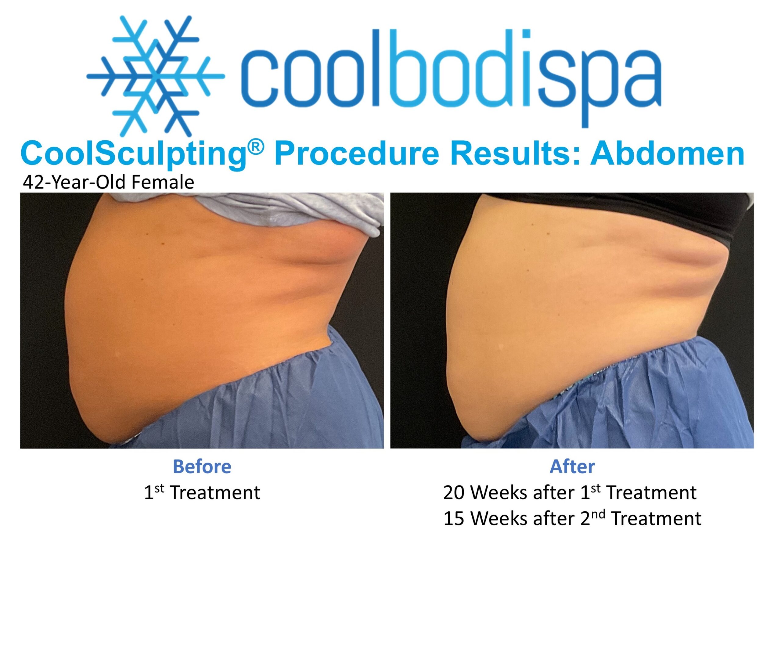 Grace H (Abs) CS Comparison Profile