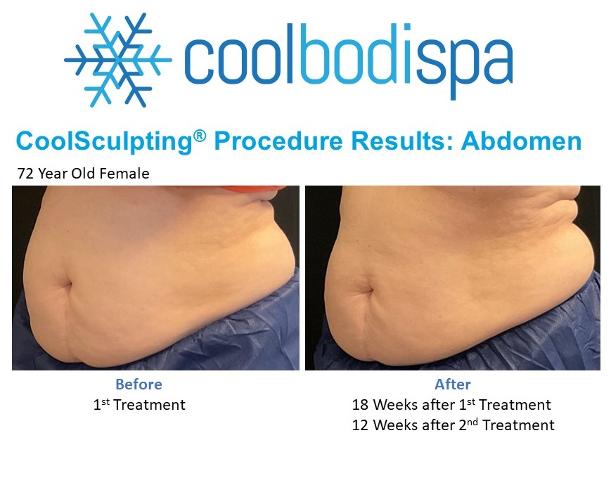 J V (U&L Abs) CS Comparison