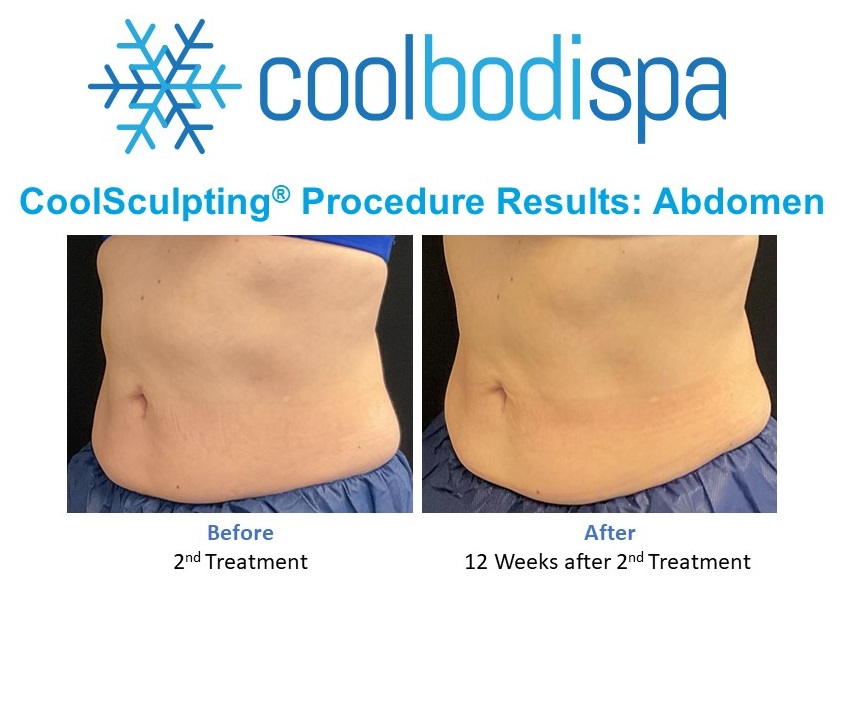 Kristy CS Abs 2022-2