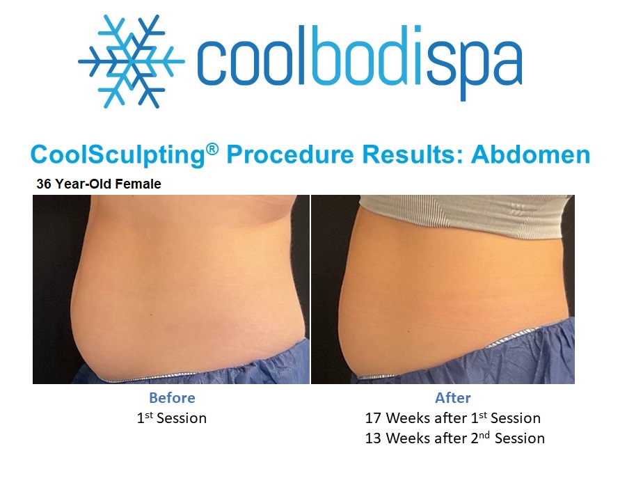 Shawna F(Abs) CS Comparison