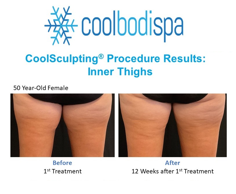 JC (Inner Thighs - Back)